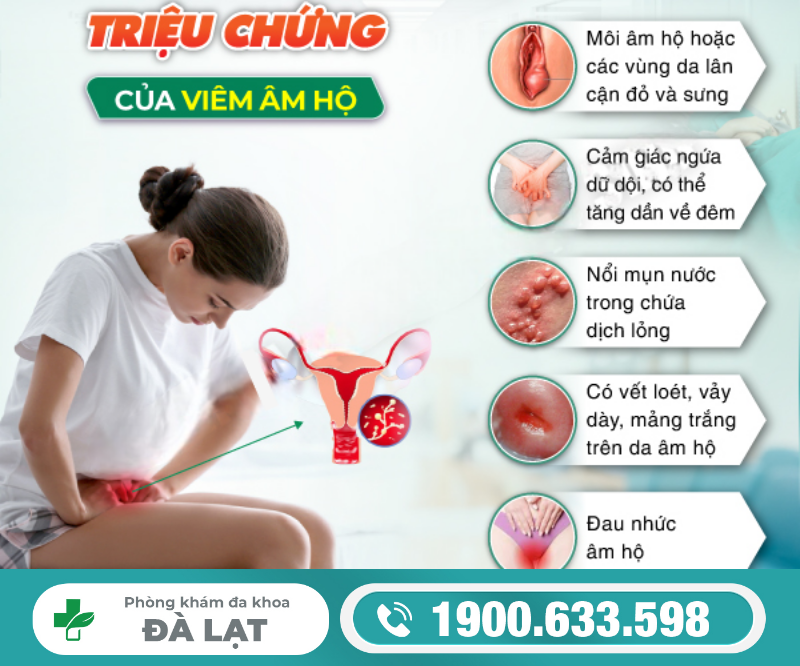 Hình ảnh minh họa